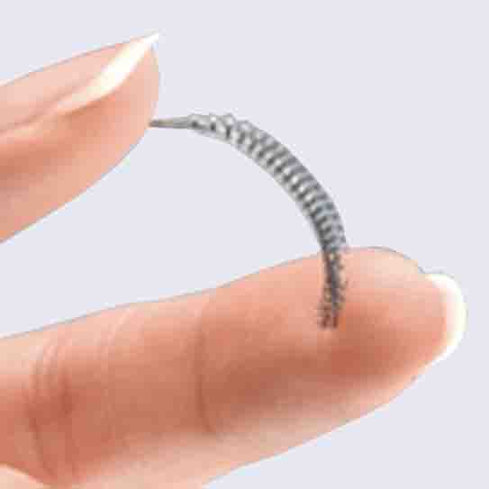 Essure